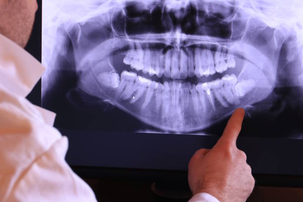 Best Emergency TMJ Treatment in Marco Island, FL